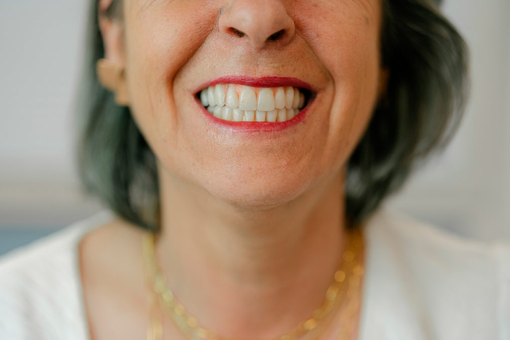 implantes de carga imediata