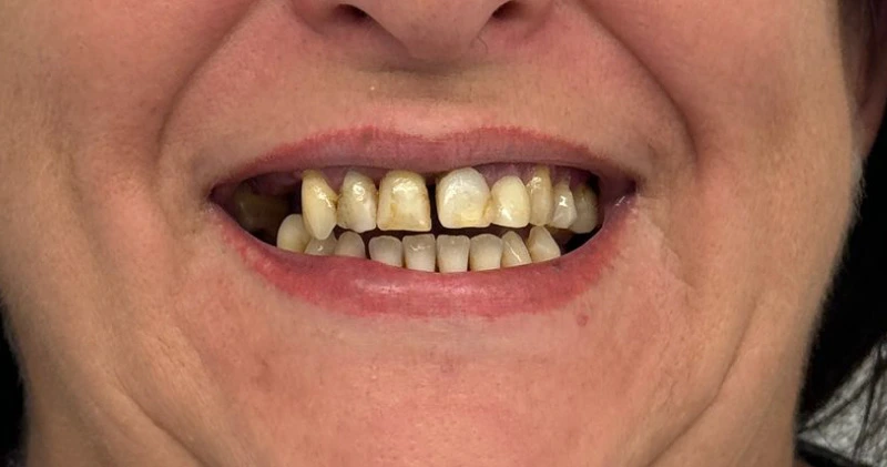 2-2